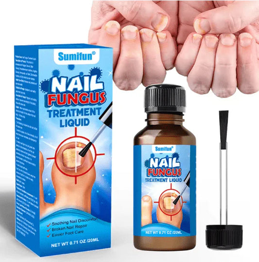 Nail Fungus Treatment Liquid – Fast Repair & Healthy Nail Care (20ml)