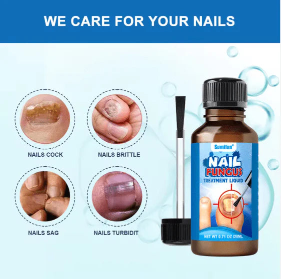 Nail Fungus Treatment Liquid – Fast Repair & Healthy Nail Care (20ml)